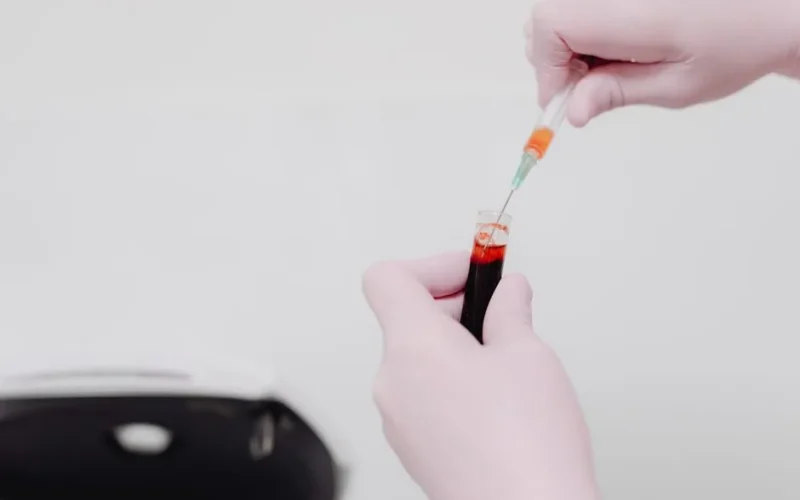 Lab technician using a syringe to handle a blood sample. Medical analysis concept.